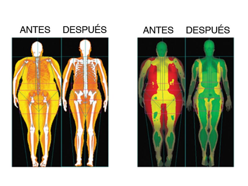 fissac _ dieta cetogénica pérdida masa grasa