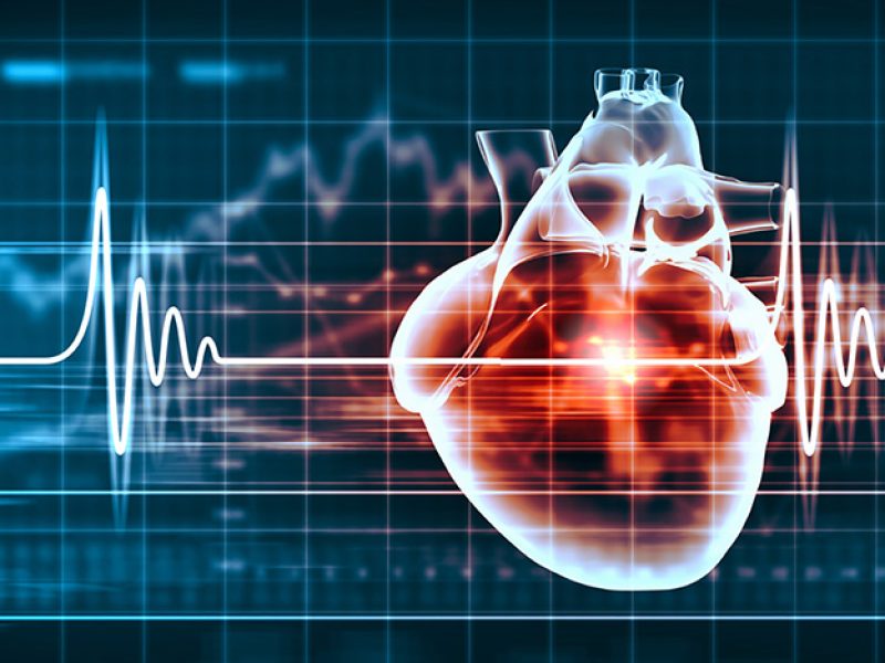 fissac_¿Cómo disminuir el riesgo de cardiotoxicidad en supervivientes de cáncer pediátrico?